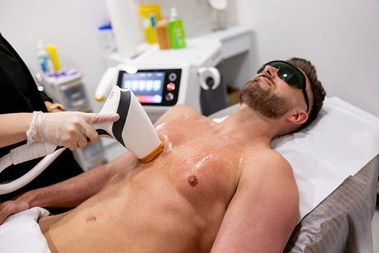 Laser Hair Reduction for Men: Why It's Trending in 2025